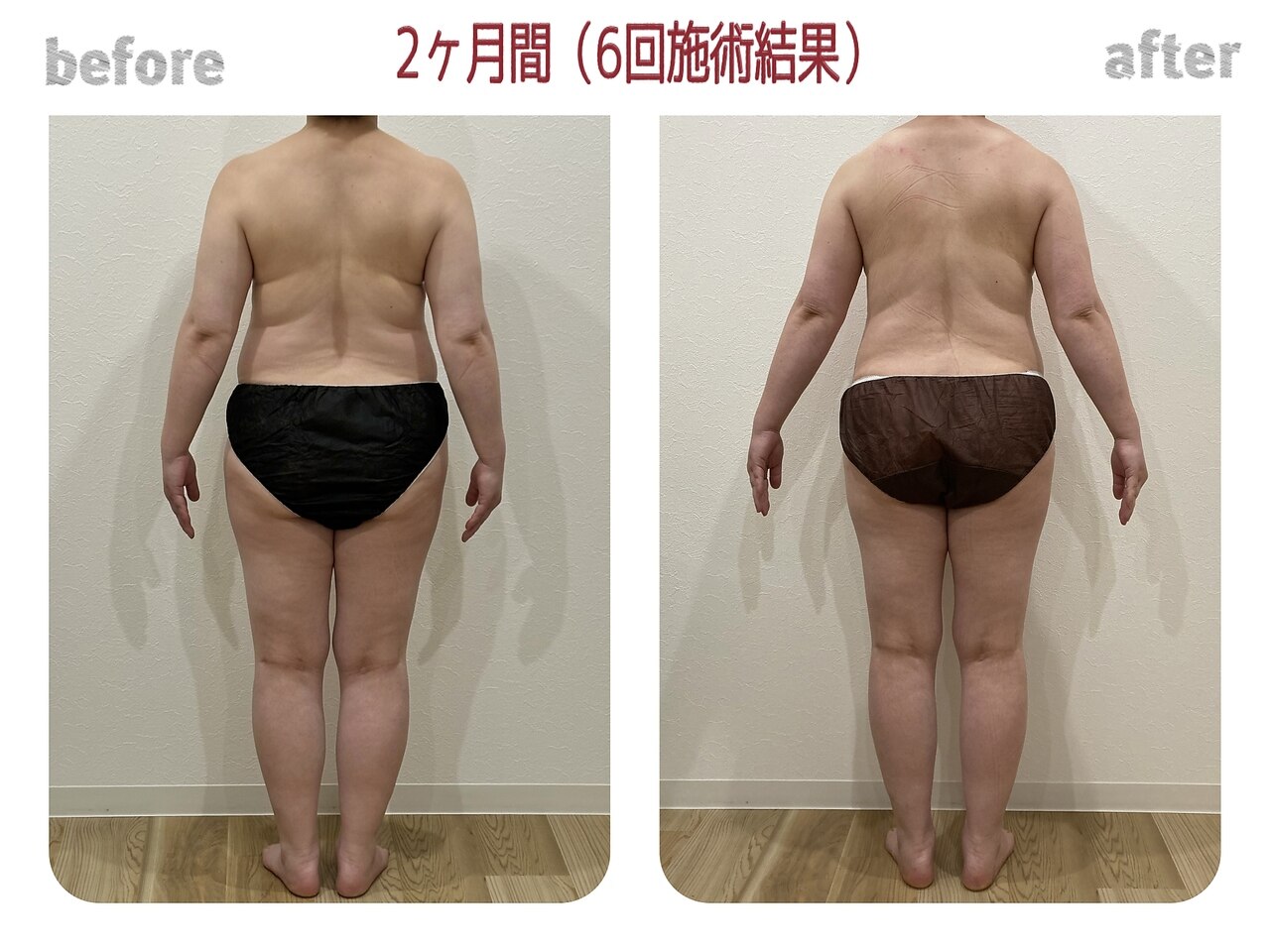 血巡り全身筋膜リンパ 120分